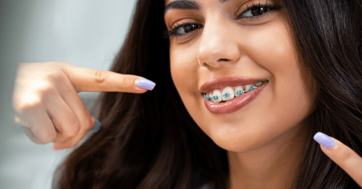 Reasons Why Plantation Parents Choose Braces For Their Kids