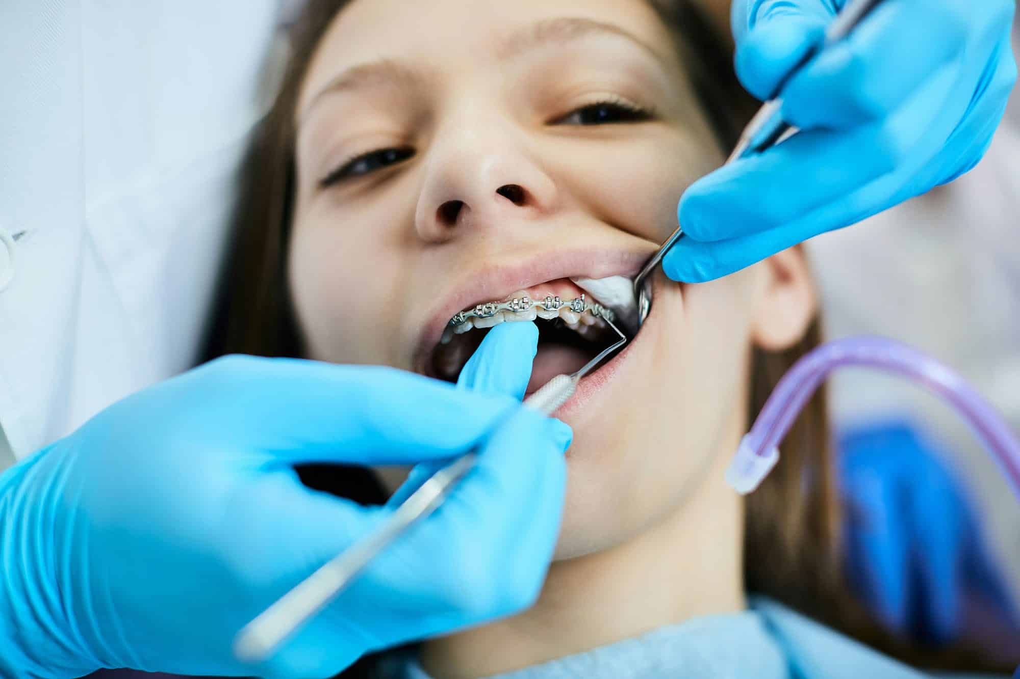 Board-certified orthodontist checking a teen patient's braces at Sunset Children's Dentistry in Lexington SC